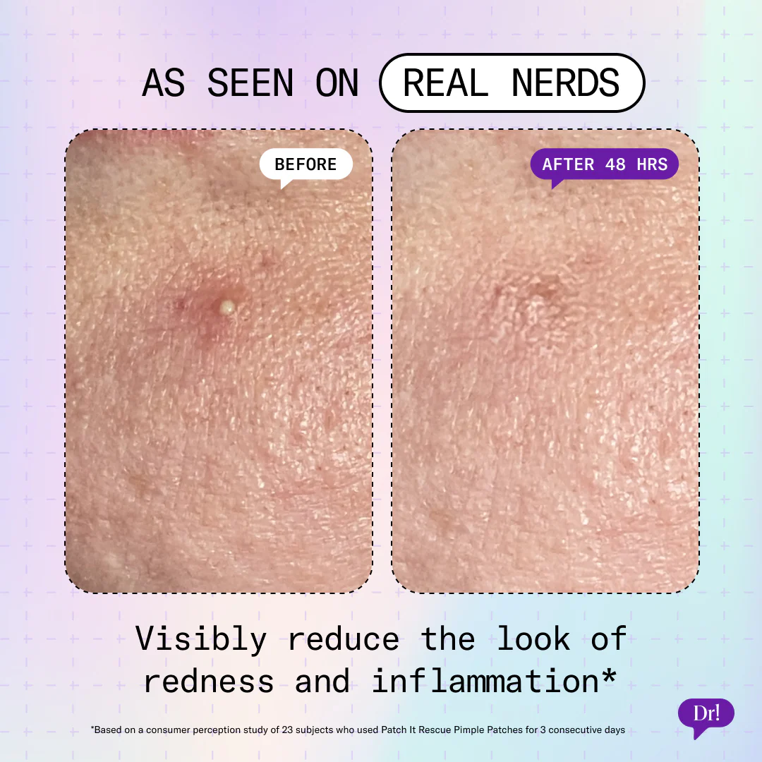 Patch It Rescue Pimple Patches 2-Pack - Image 3